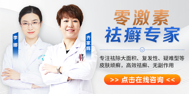 咨询
