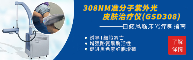 咨询